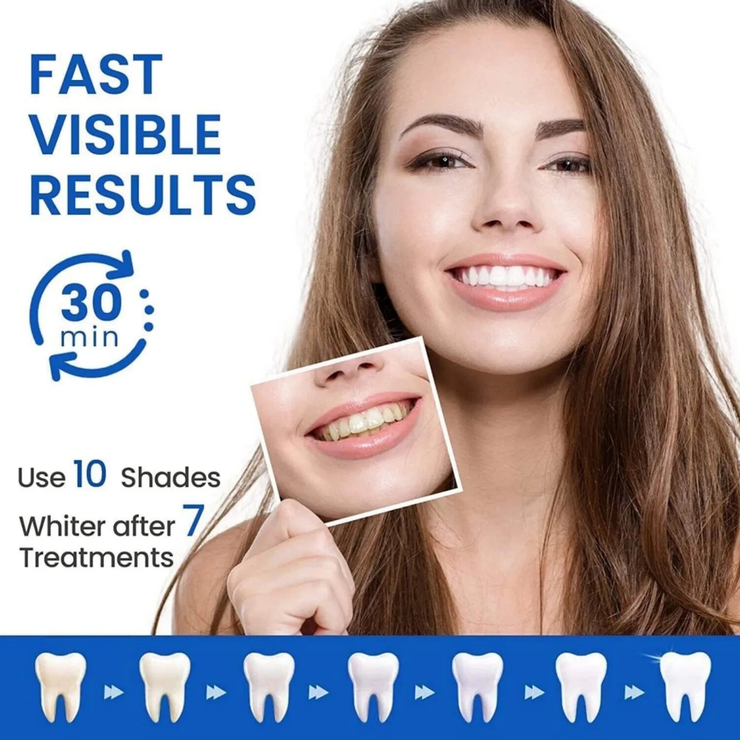 Radiant Smile Whitening Strips